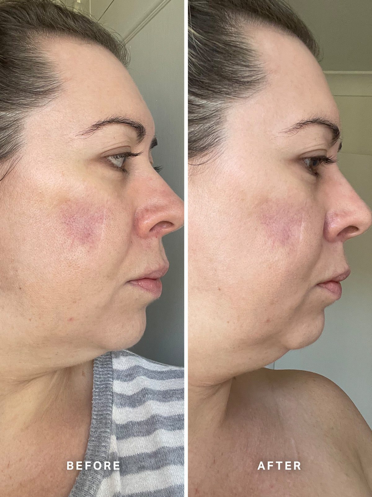 Alpha-H Vitamin A Serum with 0.5% Retinol | Alpha-H Skincare