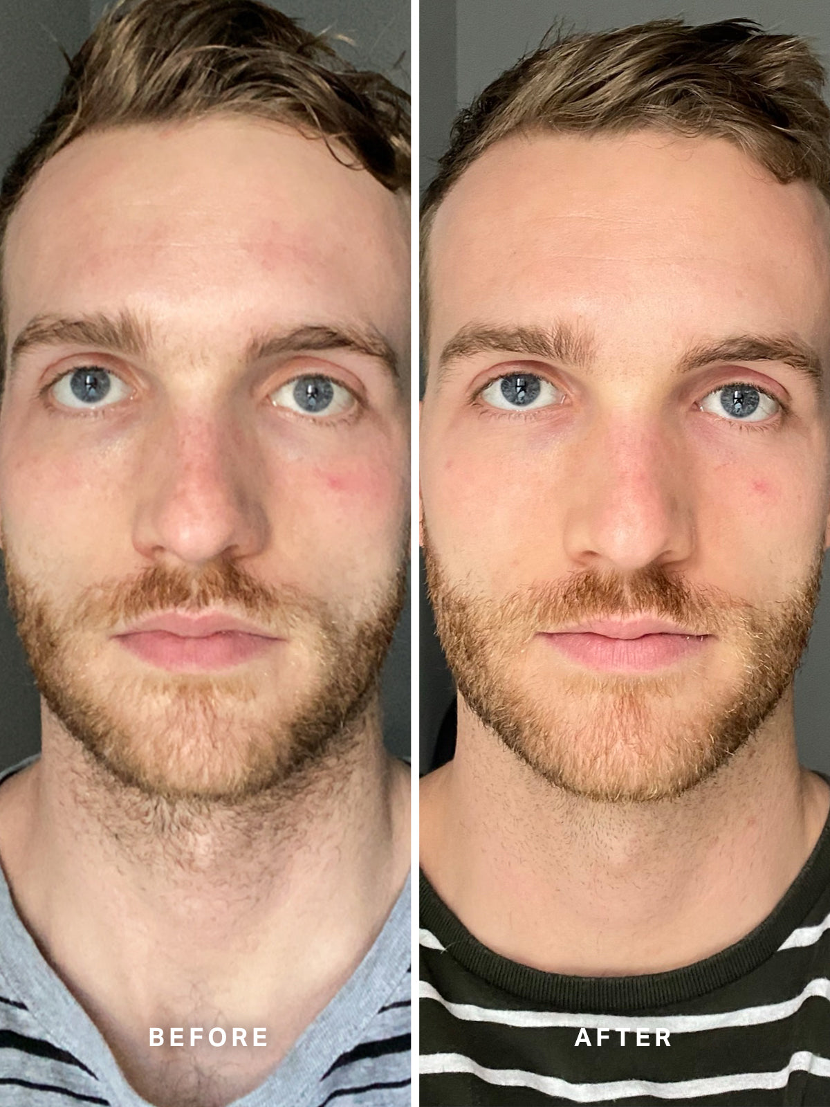 Alpha-H Vitamin B Serum 5% Niacinamide | Alpha-H Skincare – Alpha