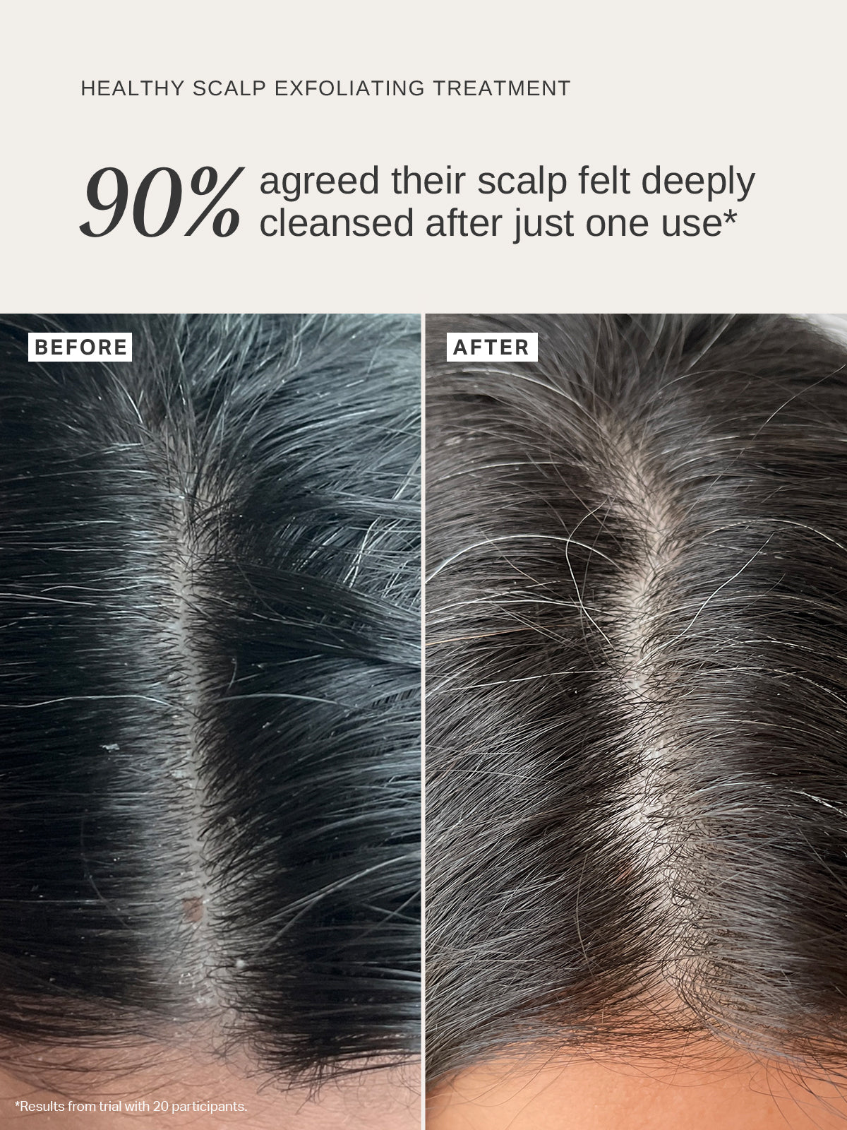 Healthy Scalp Exfoliating Treatment