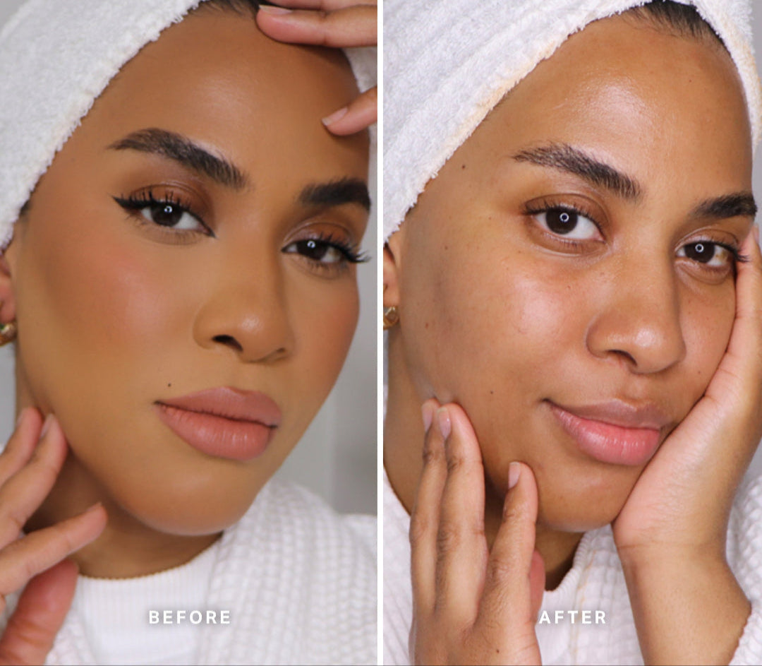 Before-And-After-Trial-MMCB_SABAH_d738bad1-b374-4b3a-ae55-3e26191f1ca1.jpg