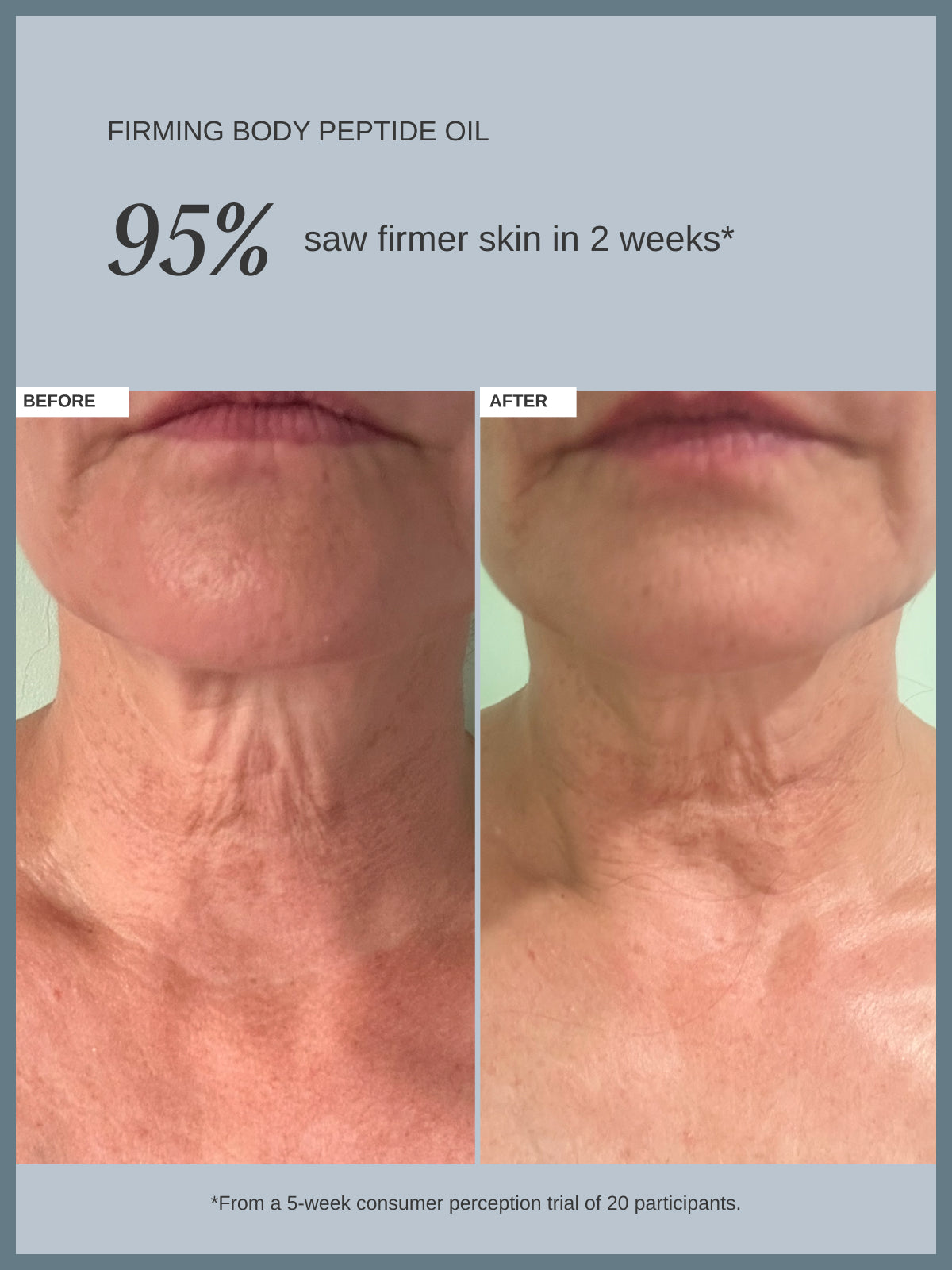 Firming Peptide Body Oil with Hexapeptide-8