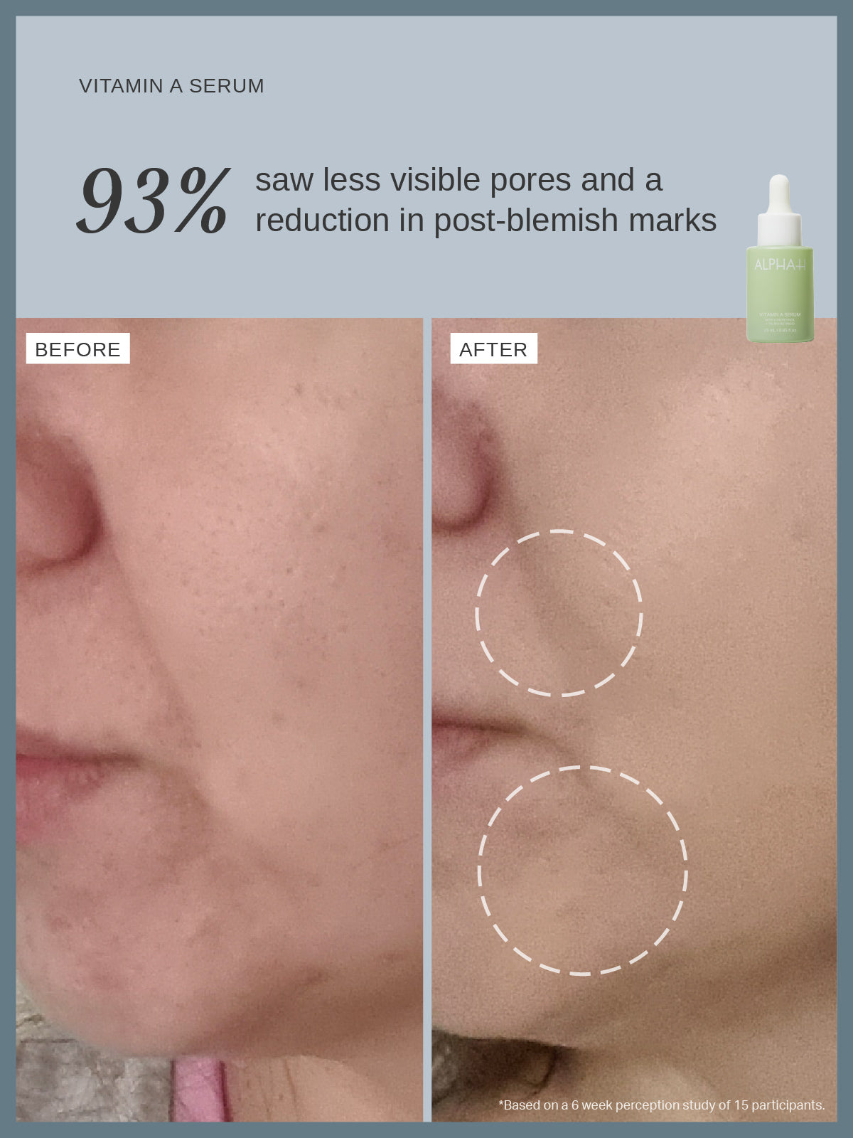 Vitamin A Serum with 0.3% Retinol and 1% Bio-Retinoid