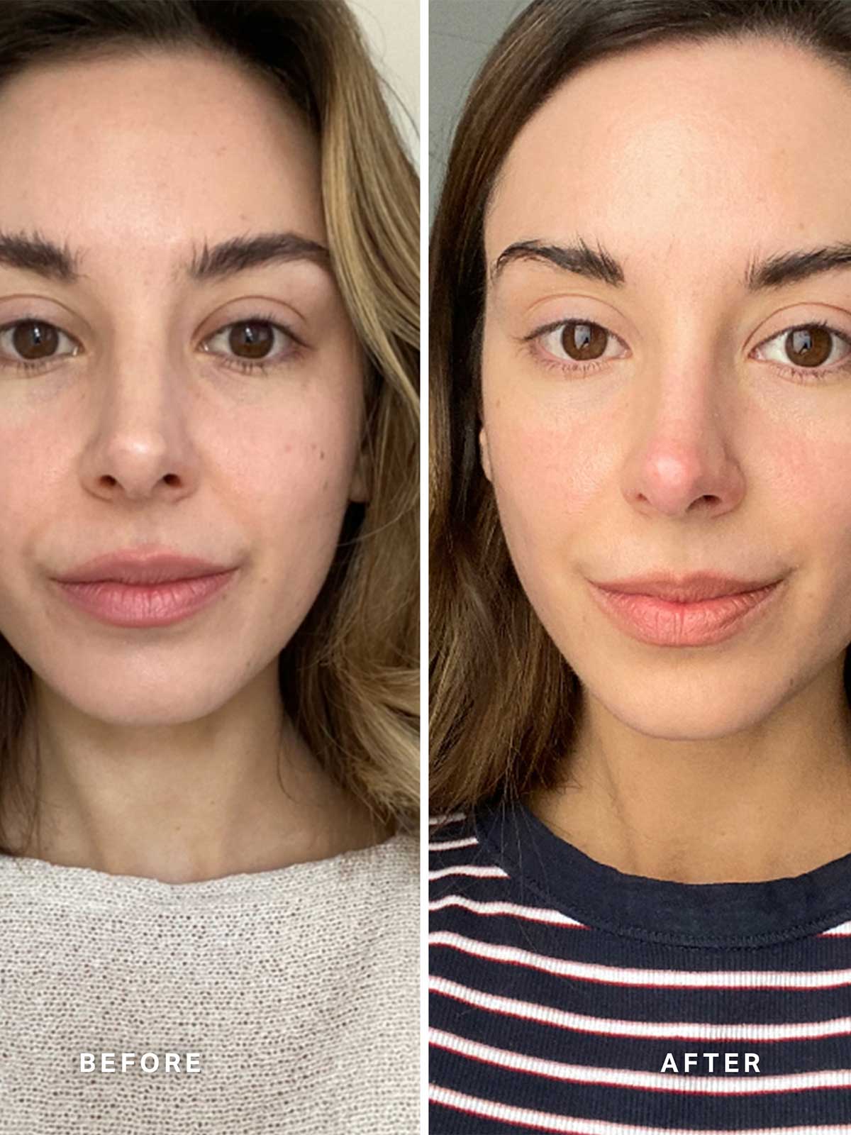 Vitamin C Serum with 10% Ethyl Ascorbic Acid 0.34 oz. – Alpha-H